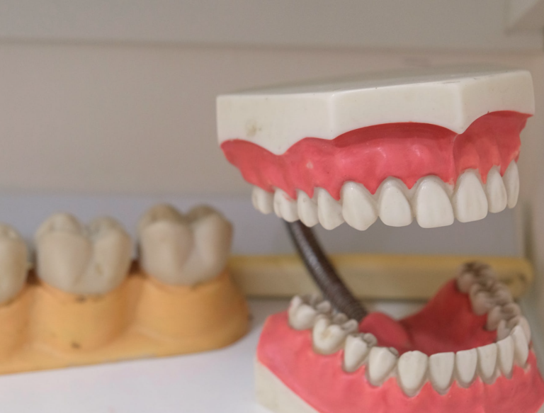 permanent dentures
