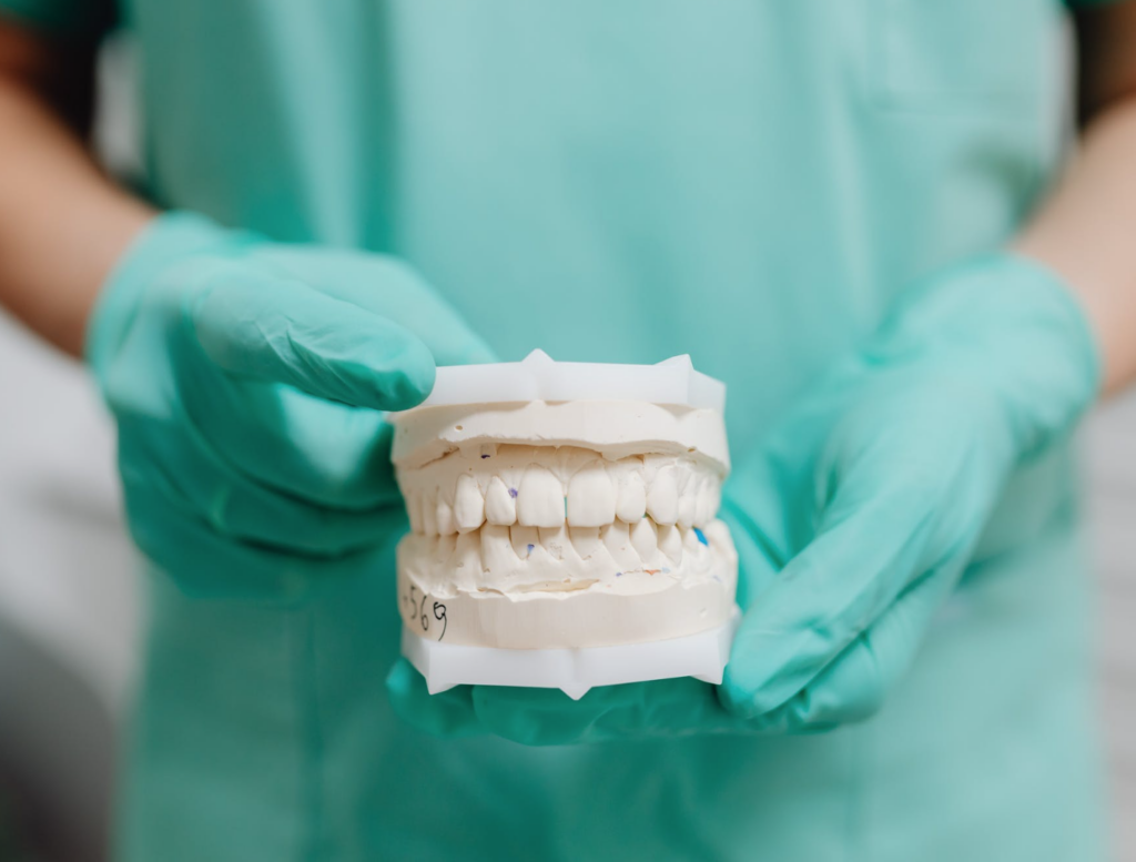 Dentist holding teeth mold