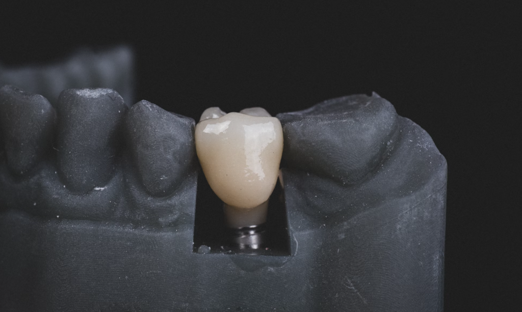 Highlighted Tooth