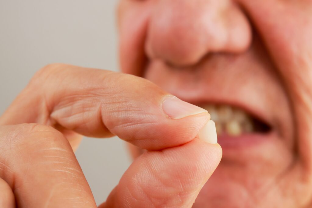 Man holding up and demonstrating his chipped tooth between his fingers.