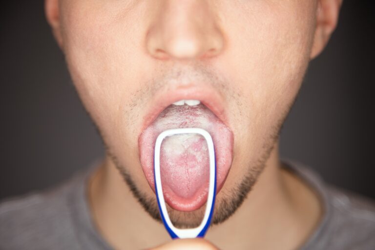 Tongue Scraper